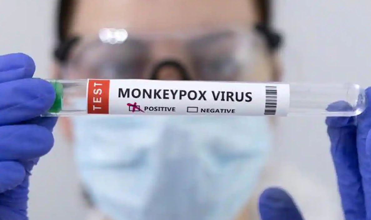 265365-monkeypox-1-copy.jpg