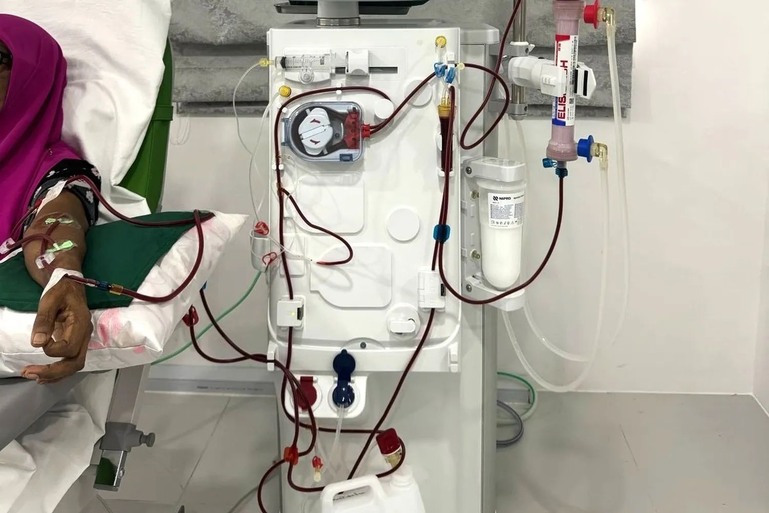 dialysis-1744697330902.webp